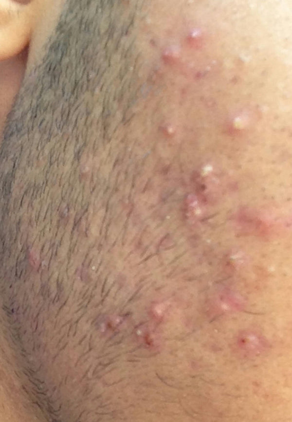 Before image for recQqS1muUopAZydC