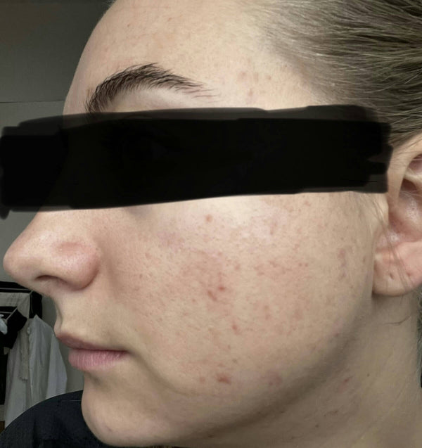 After image for recT5QkjsW6QtsxlZ