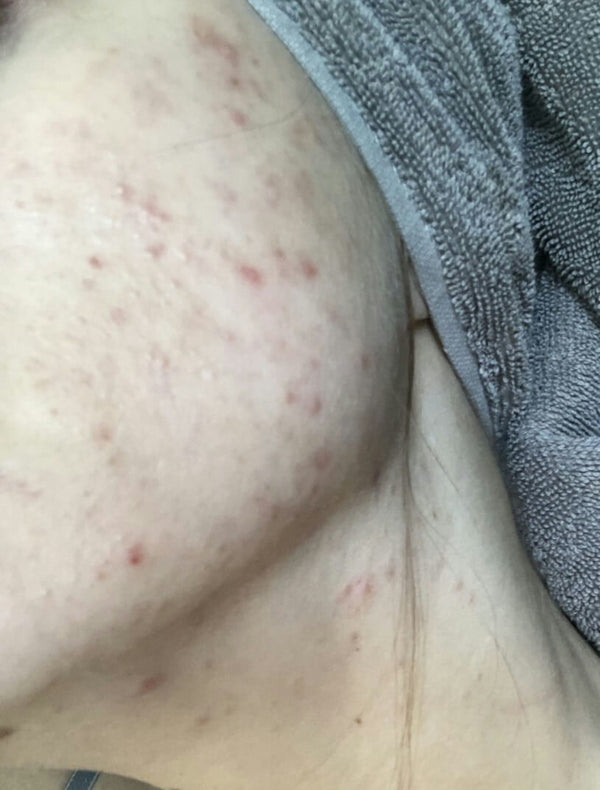 Before image for recT5QkjsW6QtsxlZ