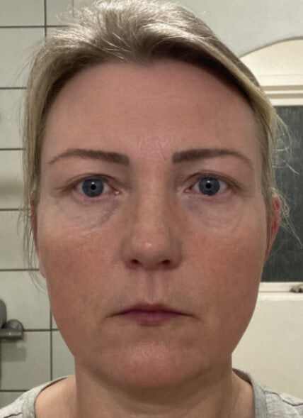 Before image for recTAfBhU8YfHB2yc