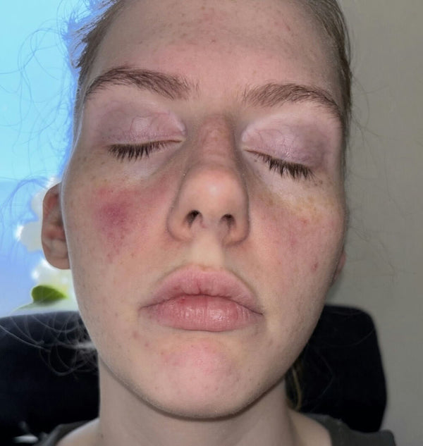 Before image for recTJgRTGkmebmPkt