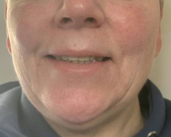 After image for recTa1lXxRO3CFpSe