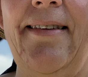 Before image for recTa1lXxRO3CFpSe