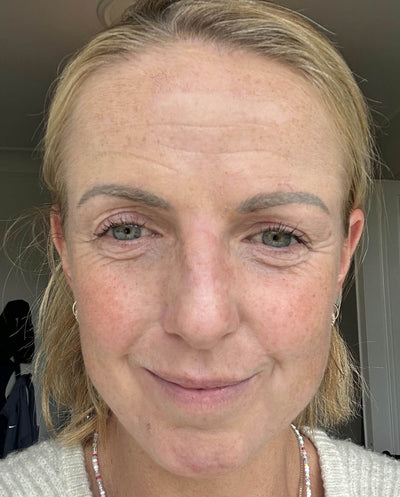 After image for recTdPL17P2bJKgMS