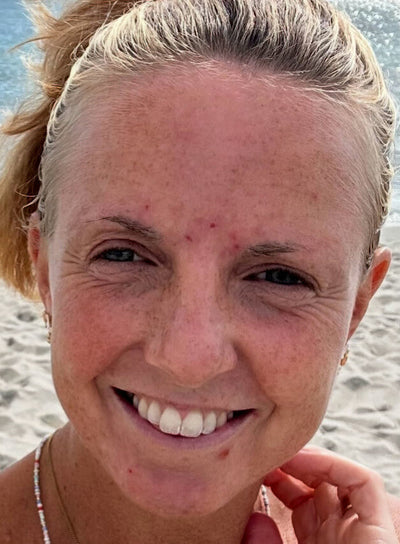 Before image for recTdPL17P2bJKgMS