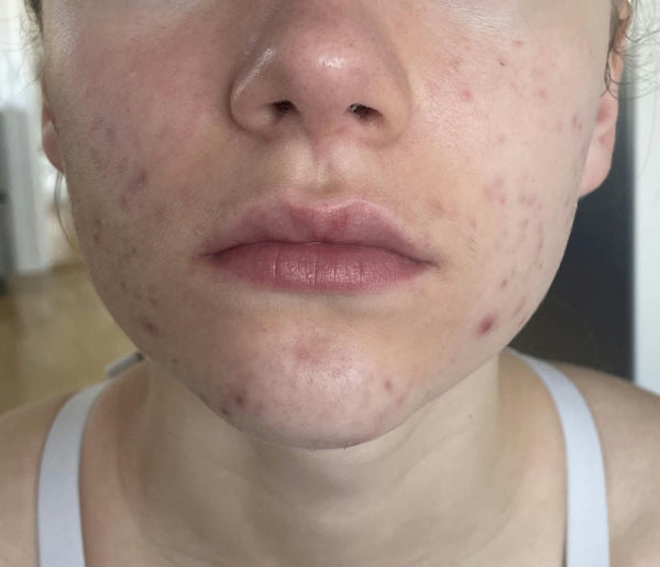 After image for recTehNS0n2LSyRsb