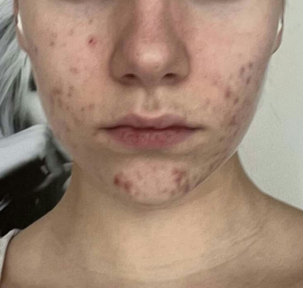 Before image for recTehNS0n2LSyRsb