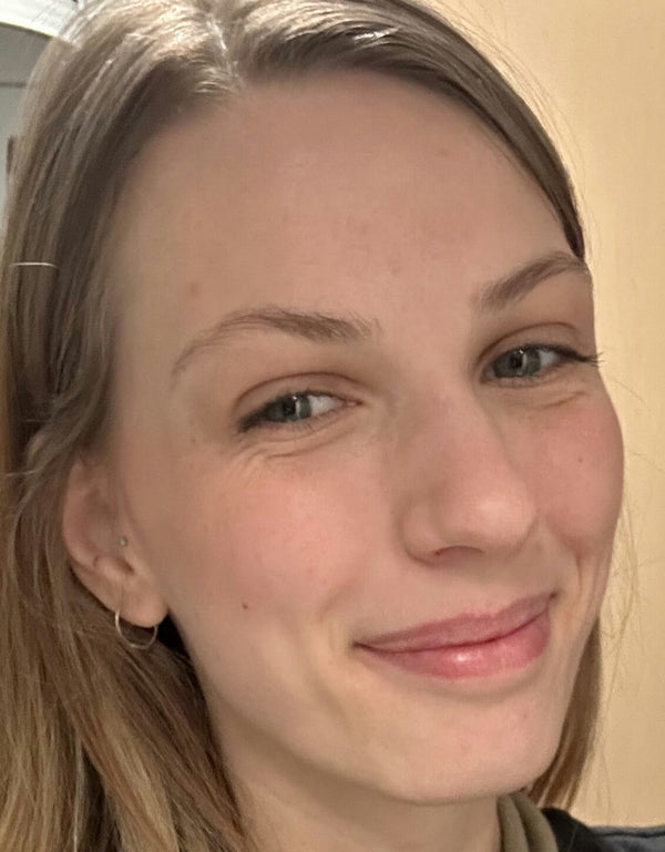 After image for recUWHsxcaJ3vqBPu