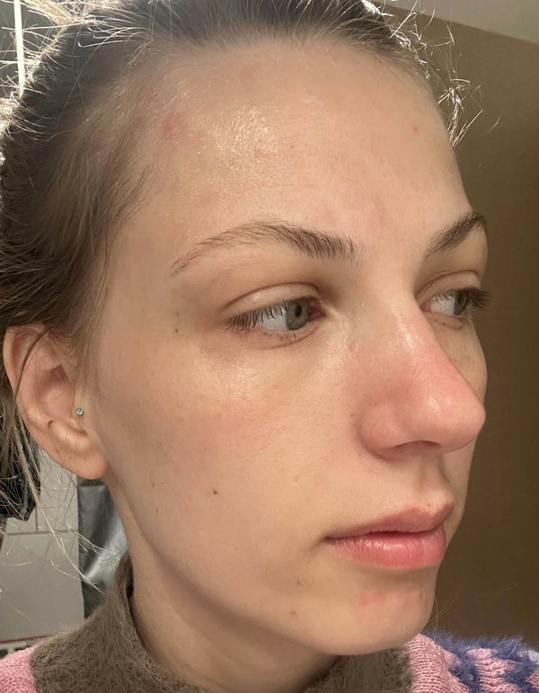 Before image for recUWHsxcaJ3vqBPu