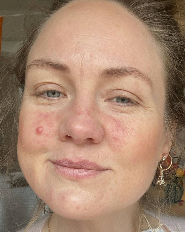 Before image for recV0Zq9cvPfQuk5b