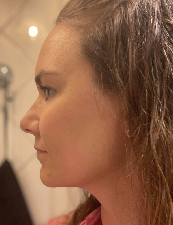 After image for recVPKnk8C4MAi0cN