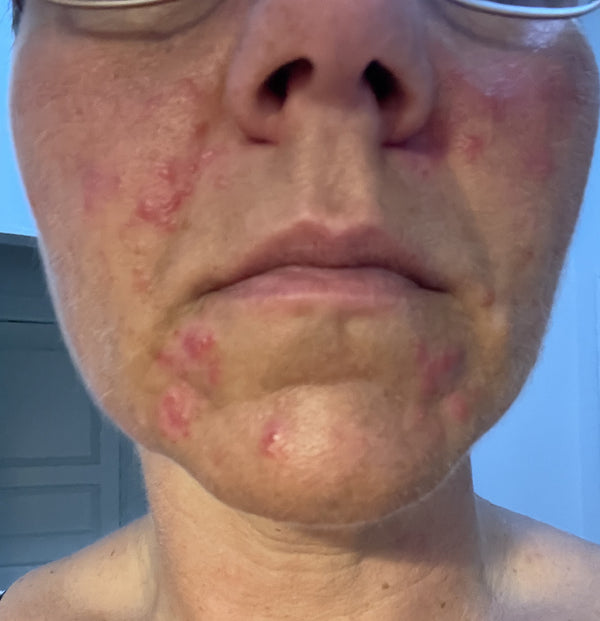 Before image for recVgHFwDxbEaV9yy