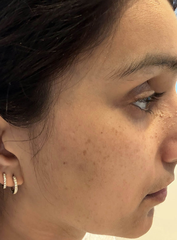 After image for recVlwCrcfLtmRR25