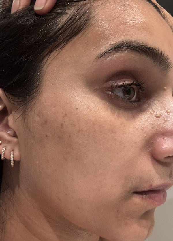 Before image for recVlwCrcfLtmRR25