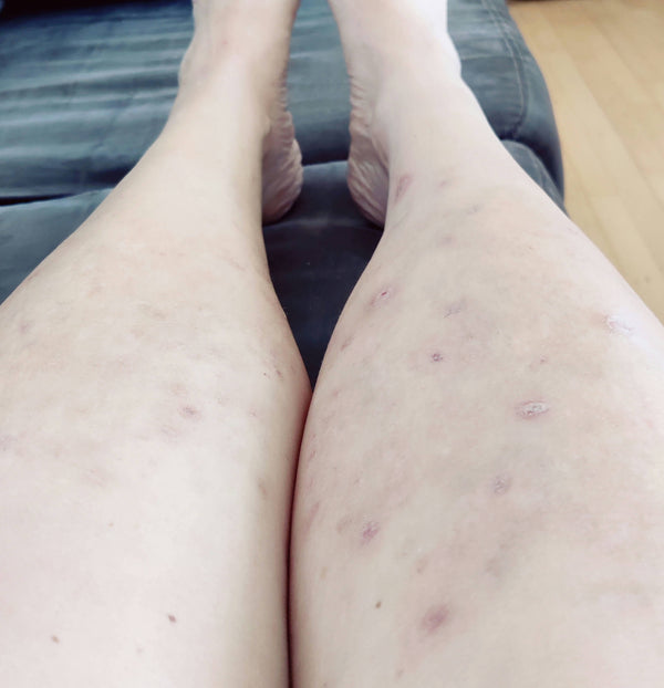 After image for recW4GSB1pbsuDtt4