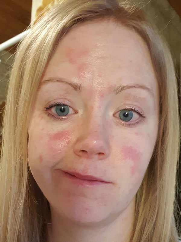 Before image for recW5dA7Qvx2vFSas