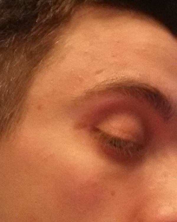 Before image for recXacYom6JjJgAZr