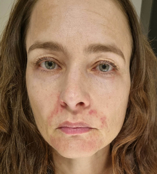 Before image for recYmynCy344QwnoD