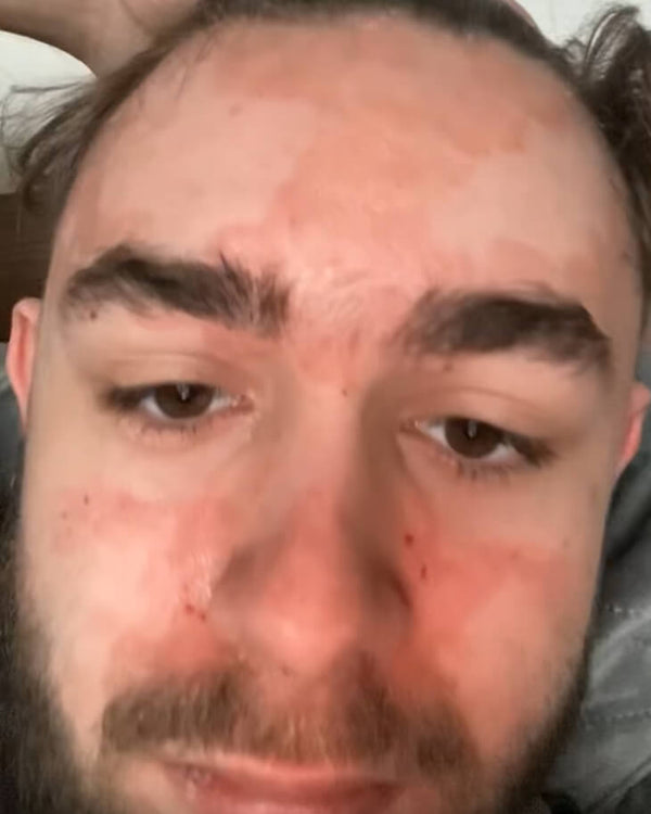 Before image for rece2WVjFbZEHZRz7