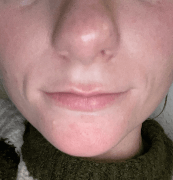 After image for recfZ3RM8A1WxNrwV