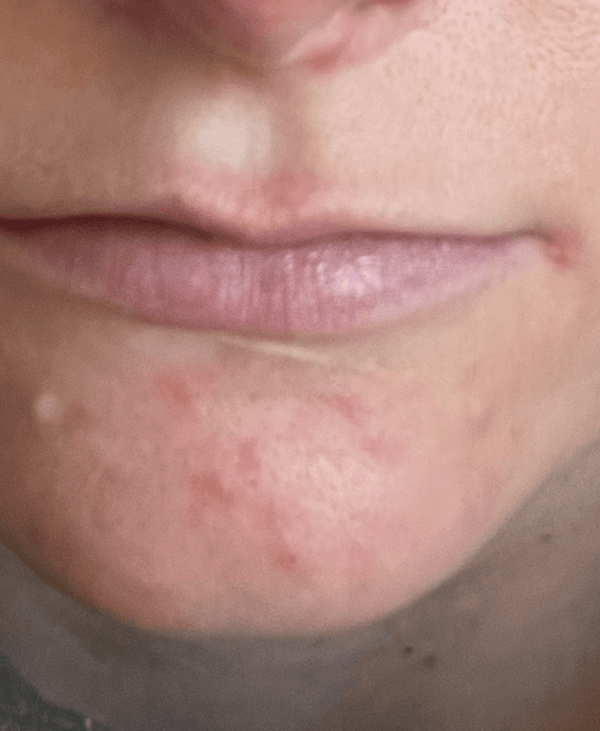 Before image for recfZ3RM8A1WxNrwV