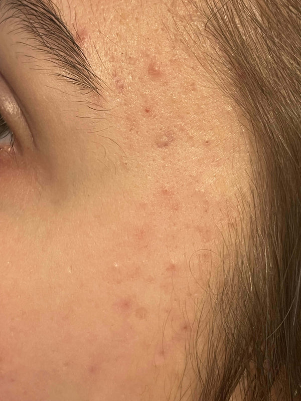 After image for rech2EFPCXVT5xe3a