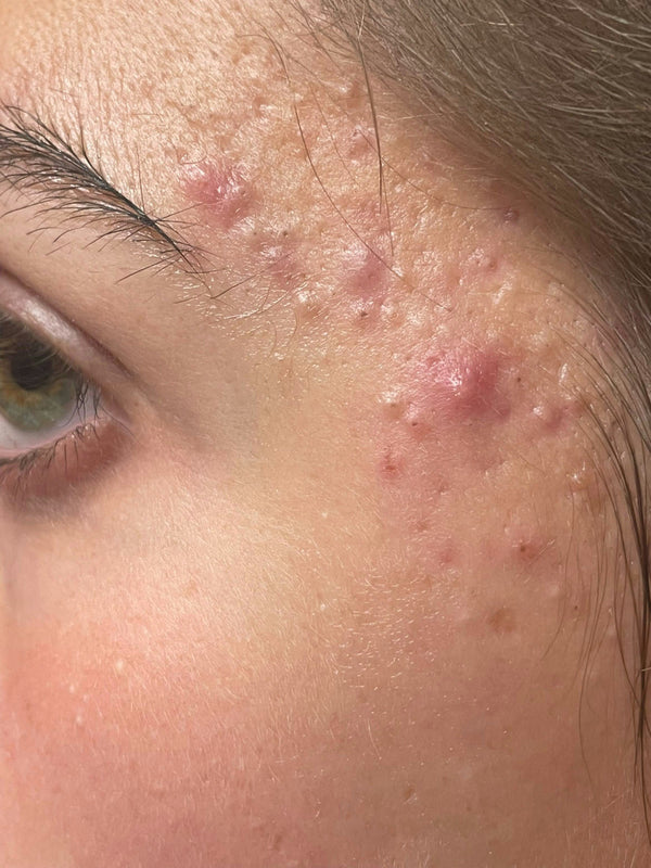 Before image for rech2EFPCXVT5xe3a