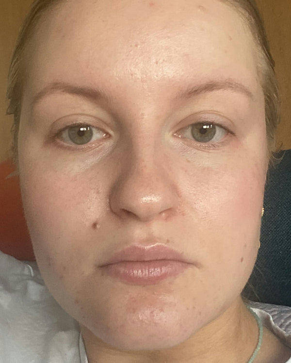 After image for rechTLu597fLXjGCA