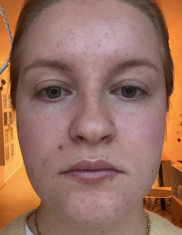 Before image for rechTLu597fLXjGCA