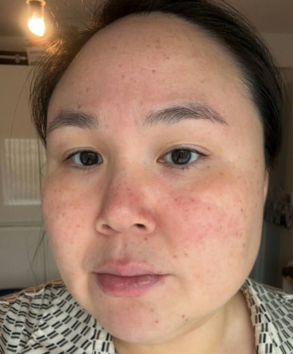 After image for rechkglKhkrCXczIp