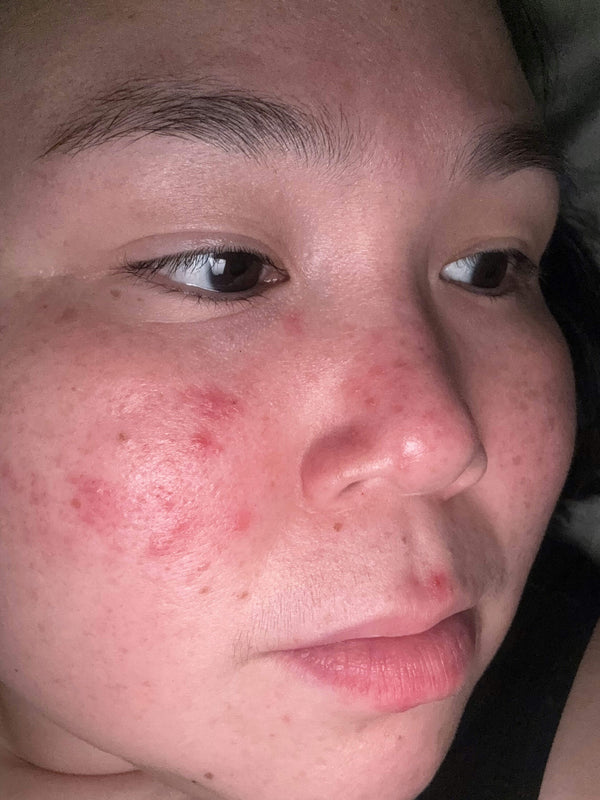 Before image for rechkglKhkrCXczIp