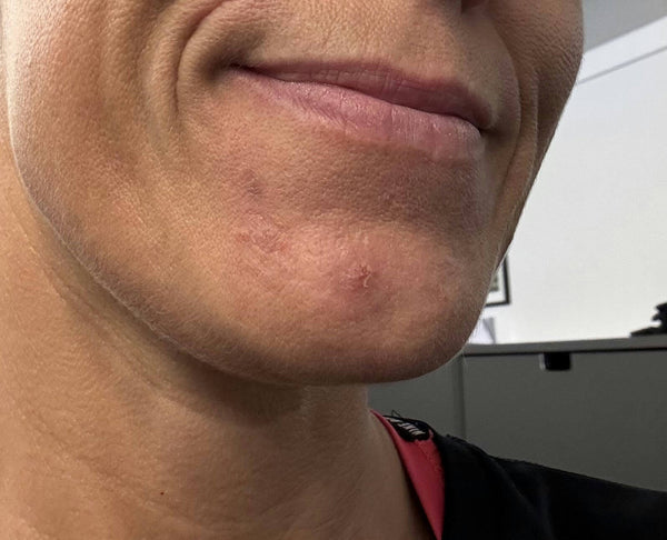 After image for recjD9t3qSBt2VTzY