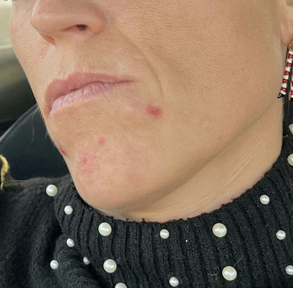 Before image for recjD9t3qSBt2VTzY