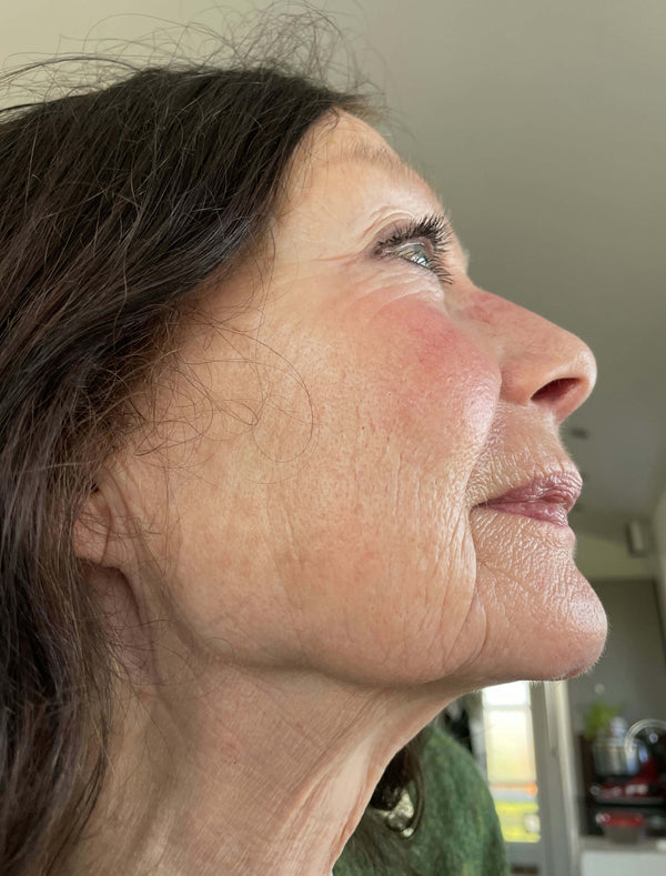 After image for reck0FiaflQ98Dq0i