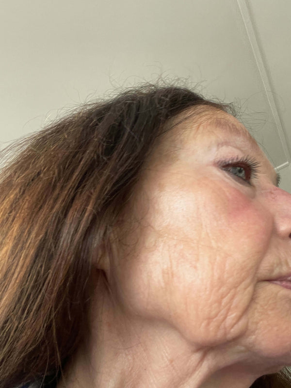 Before image for reck0FiaflQ98Dq0i