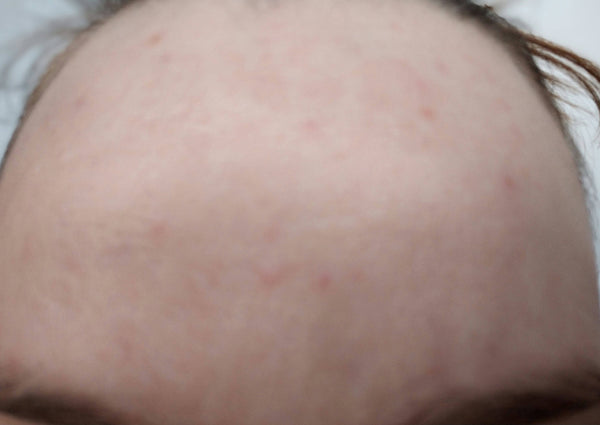 After image for recmtD2Id5tsiRi37