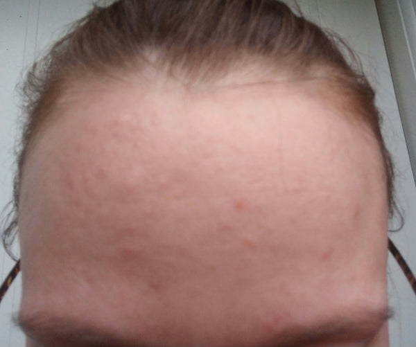 Before image for recmtD2Id5tsiRi37