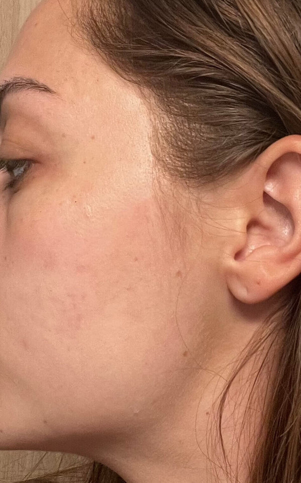 After image for recoVdYj5dfZNUGuD