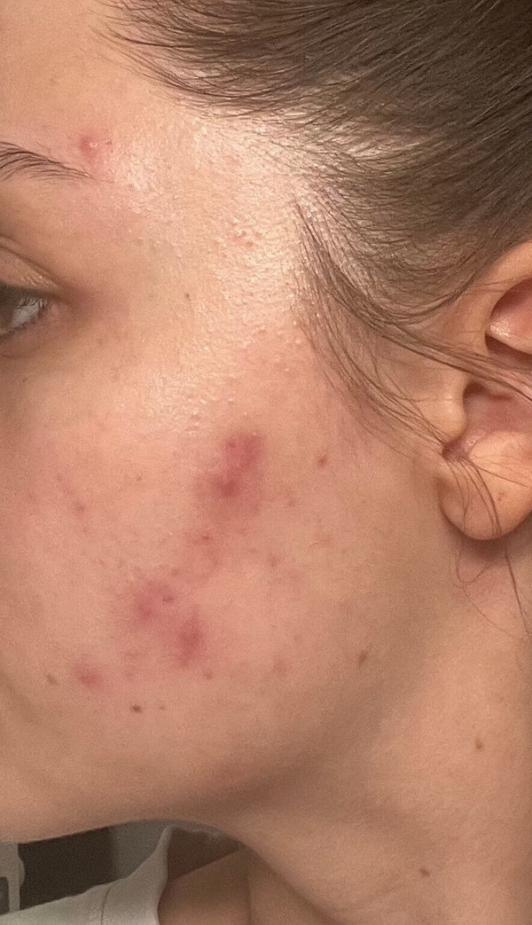 Before image for recoVdYj5dfZNUGuD