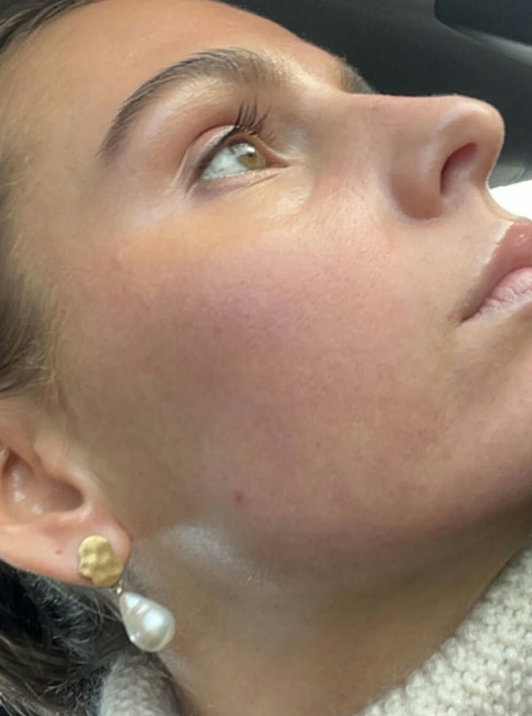 After image for recpTBc1jcwQs0xtA