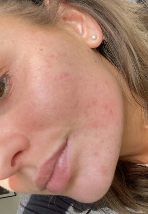 Before image for recpTBc1jcwQs0xtA