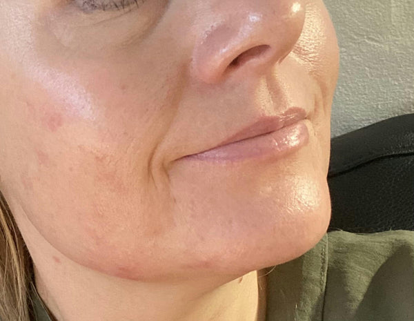 After image for recr7Um6iuqfBS1gm