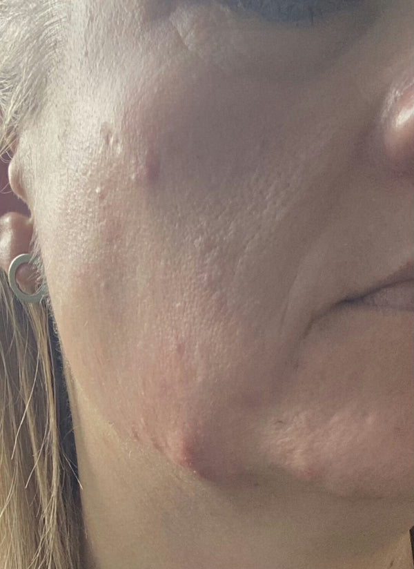 Before image for recr7Um6iuqfBS1gm