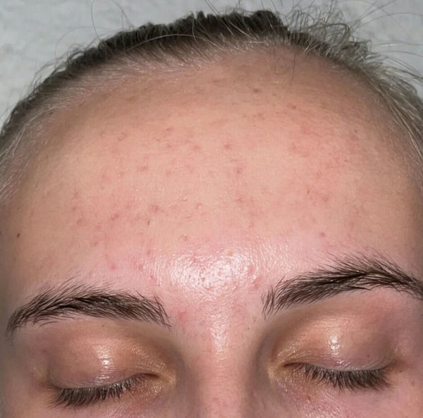 After image for recrLB1Ua50oxsJyi