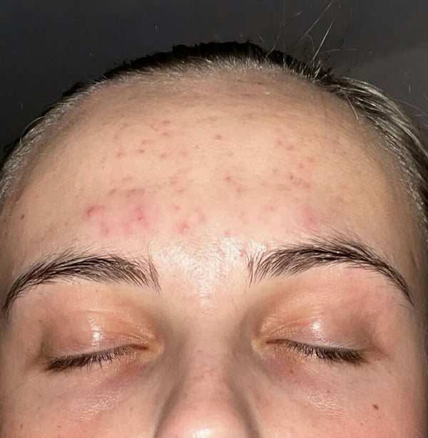 Before image for recrLB1Ua50oxsJyi