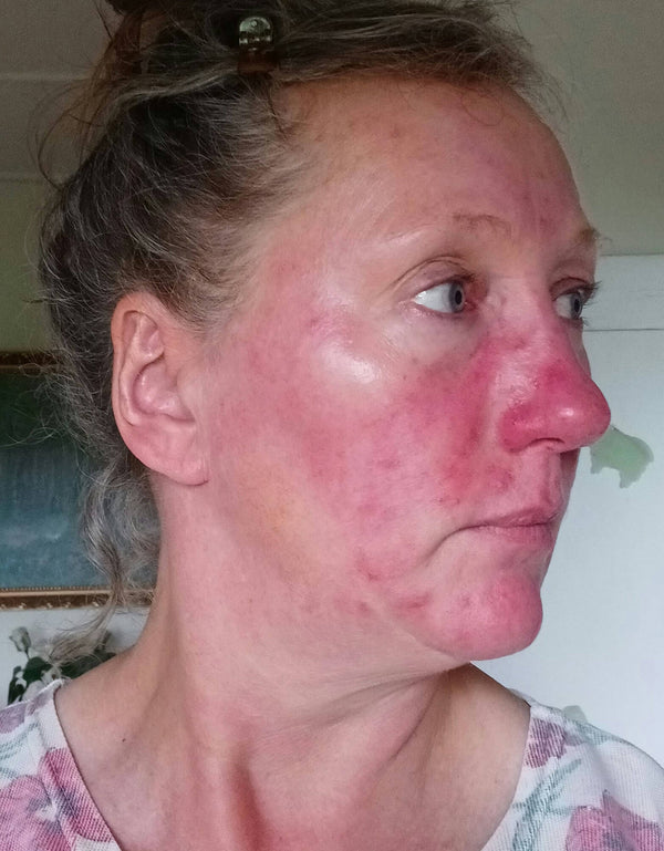 After image for recstq7PjTkEsXhEE