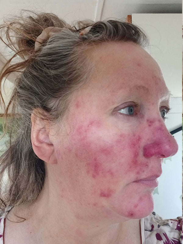 Before image for recstq7PjTkEsXhEE