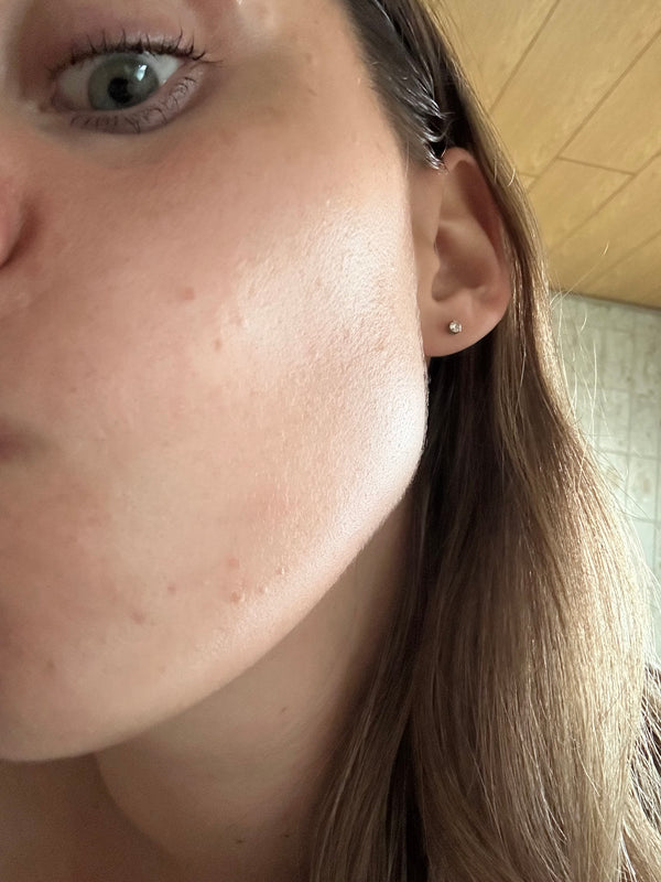 Before image for rectOjuvCoGEQZV9t