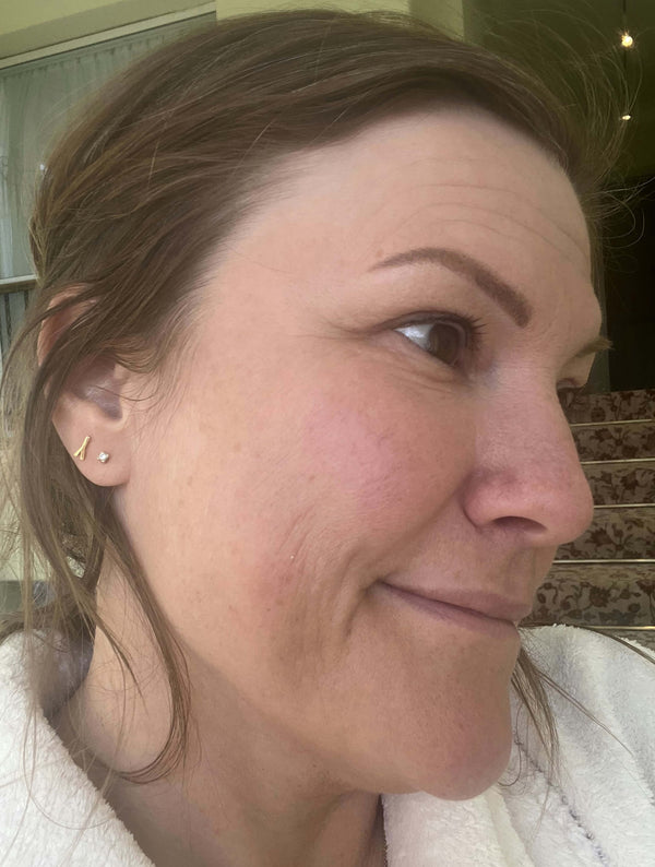 After image for rectli6m5C2C5vpmg