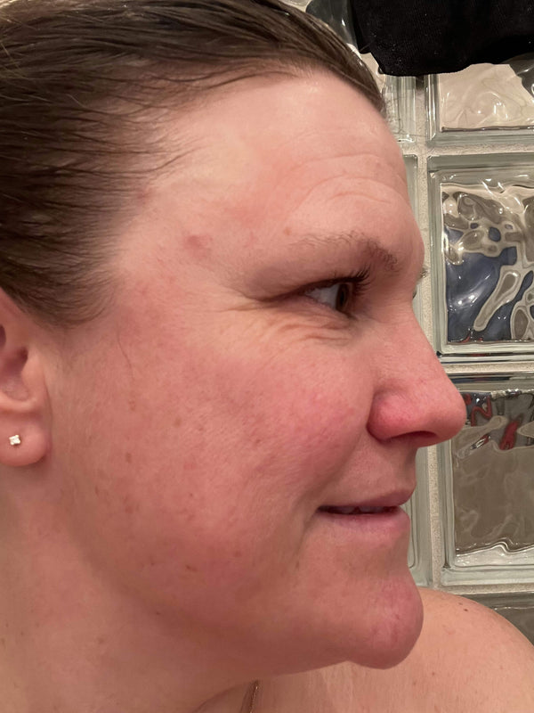 Before image for rectli6m5C2C5vpmg